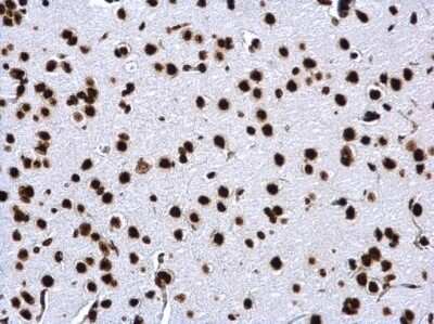 Immunohistochemistry-Paraffin: HIST1H3A [ac Lys18] Antibody [NBP2-43535]